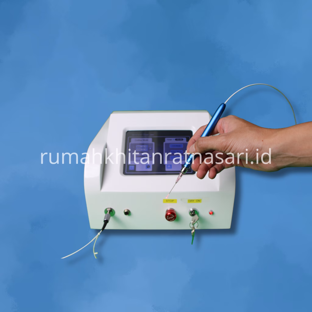 metode sunat laser