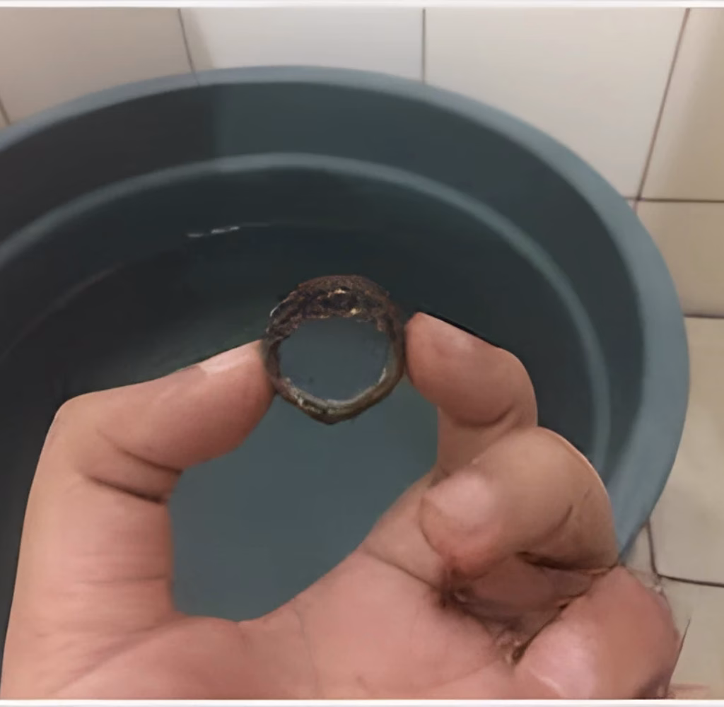 sunat cincin