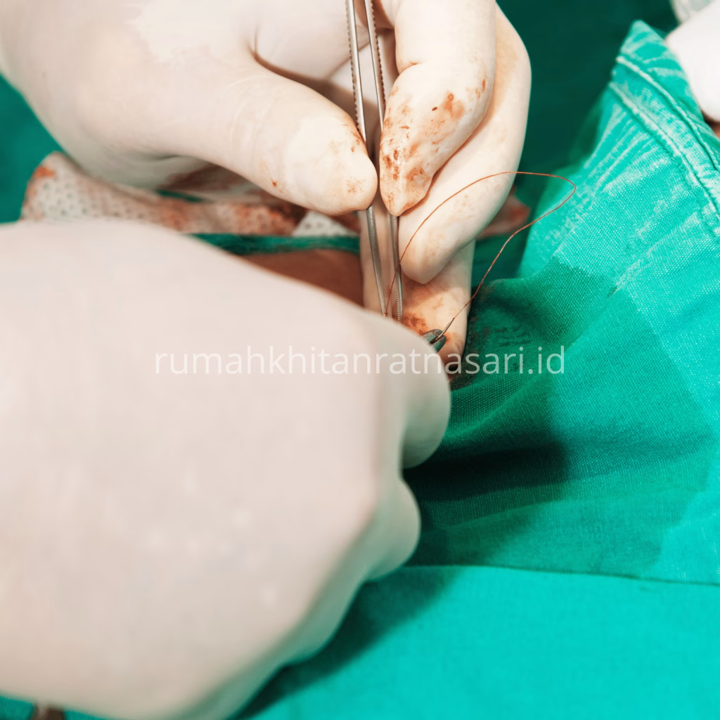 Apa Itu Khitan (Sunat) dan Mengapa Dianjurkan Secara Medis?